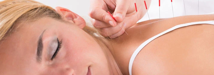 Chiropractic Powell OH Acupuncture